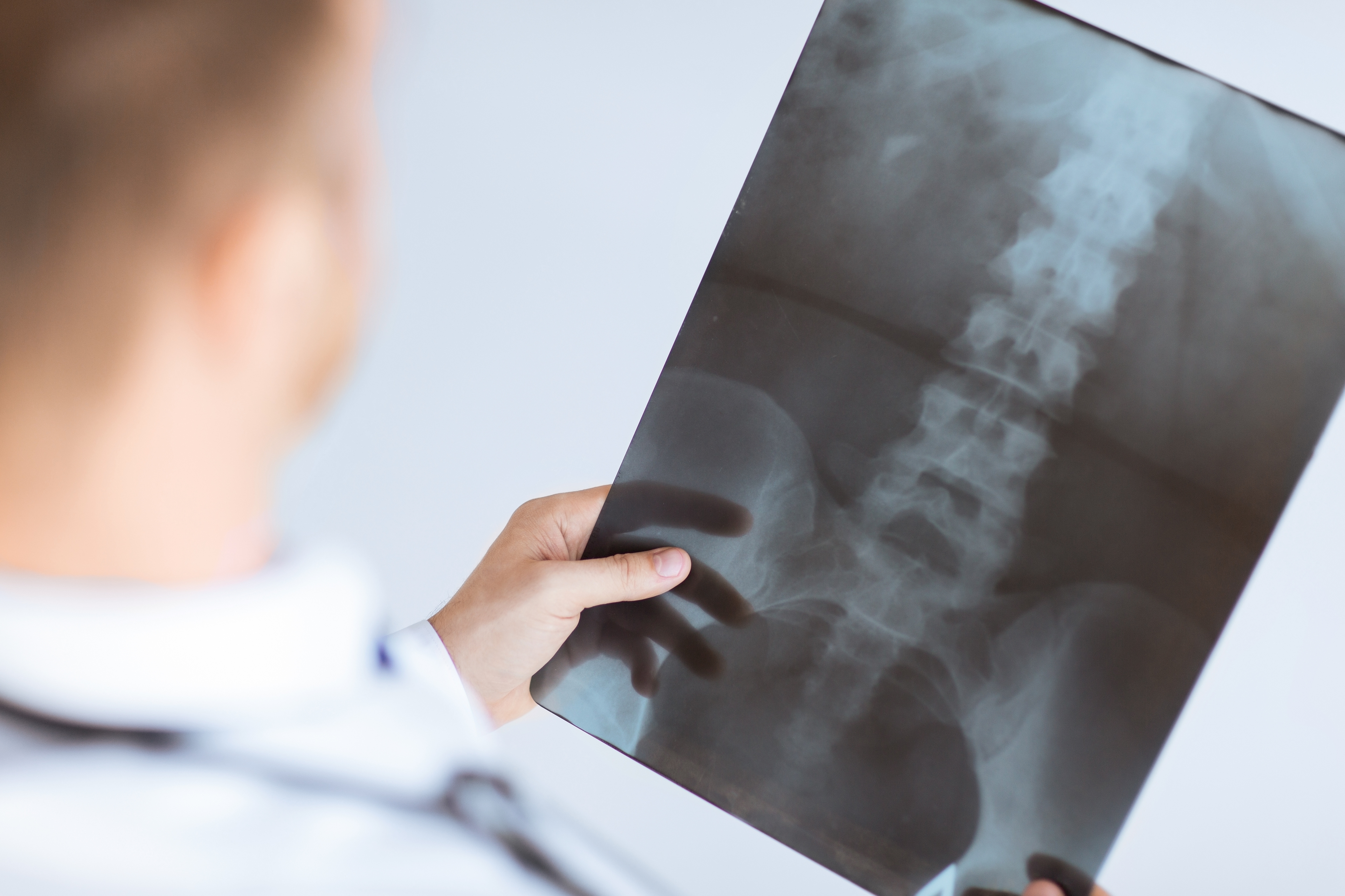 X-ray 검사